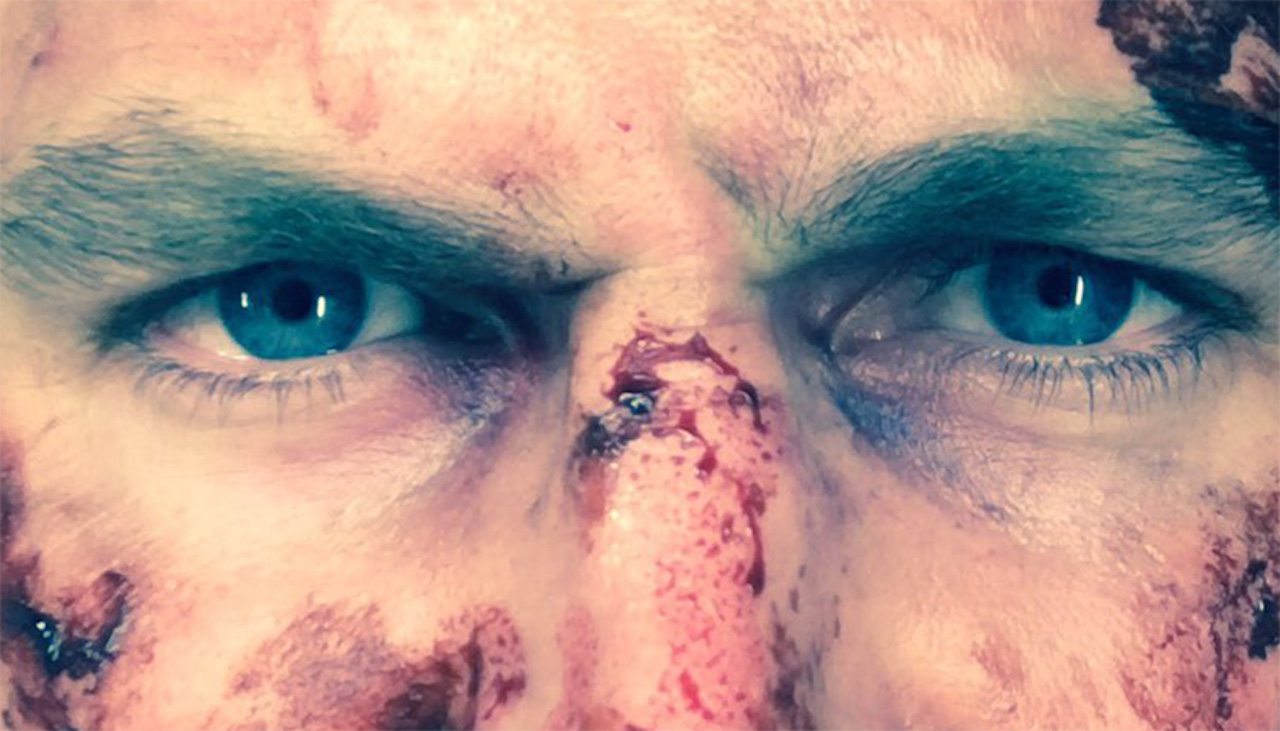 Arrow 5 – Oliver Queen ha il volto insanguinato nella foto di Stephen Amell